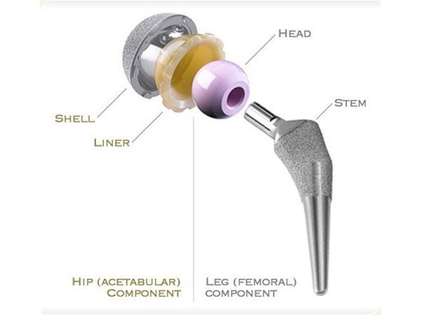 Total Knee Replacement Surgery